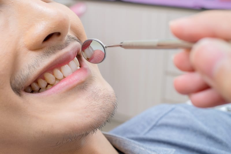 Young man using his benefits to get his teeth checked