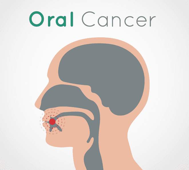 Oral cancer logo